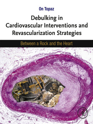 cover image of Debulking in Cardiovascular Interventions and Revascularization Strategies